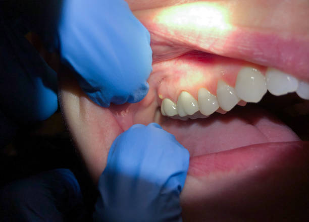 Best Emergency Root Canal Treatment in Belton, TX