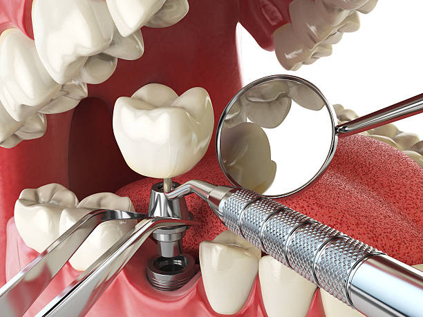 Best Broken or Cracked Tooth Emergency Dentist in Belton, TX